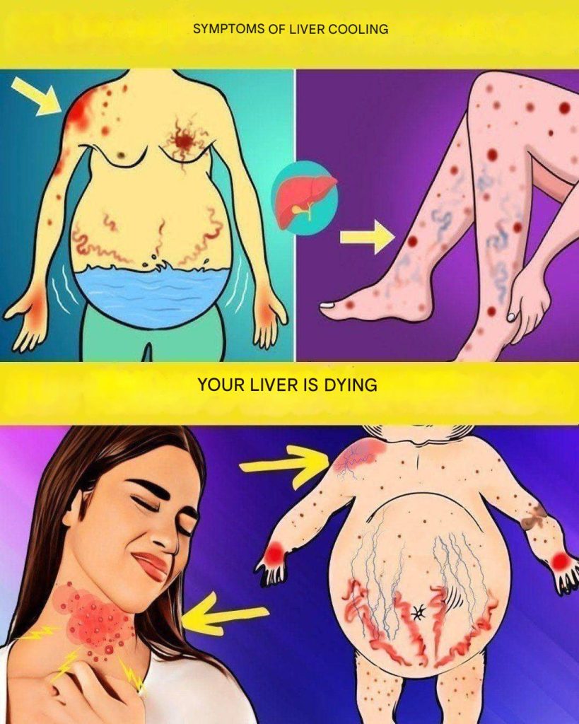17 Signs That Something’s Wrong With Your Liver