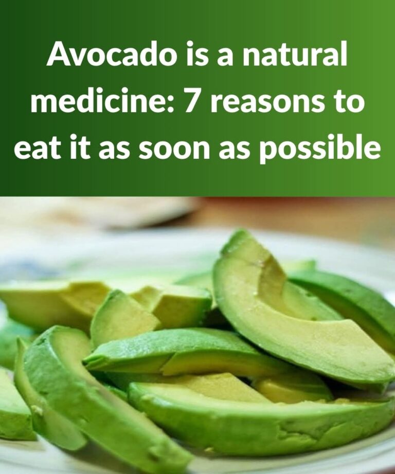 7 Health Benefits of Eating Avocados