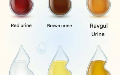 What The Color Of Your Urine Says About Your Health