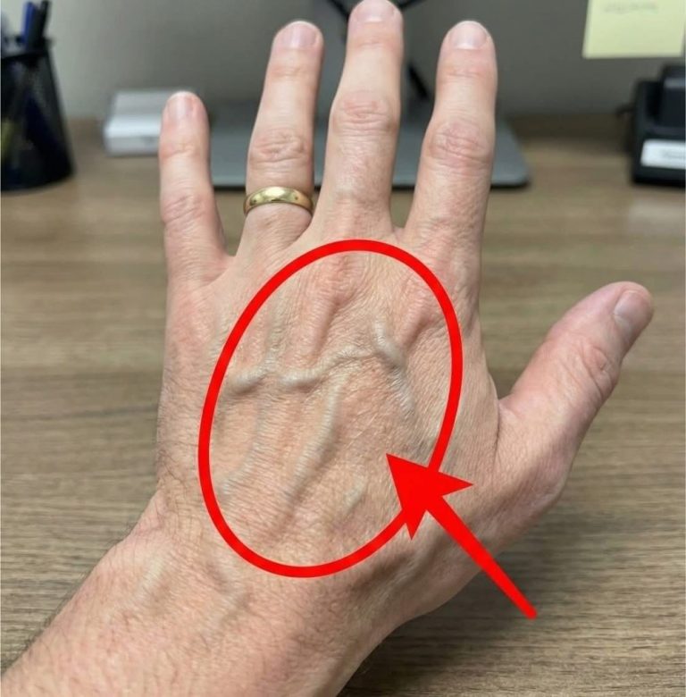 If you have visible veins, it means you are…