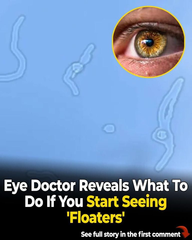 What Are Eye Floaters? Here What To Do If you Start Seeing Them, According to an Eye Doctor