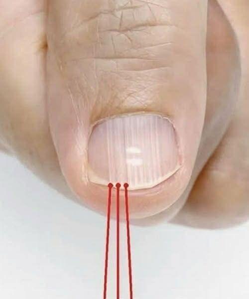 If Lines Start Appearing On Your Nails After 40, It Could Be A Warning Sign…