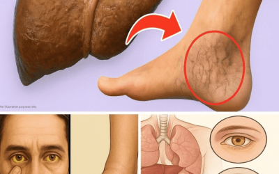 15 Silent Signs Your Liver Is in Trouble – Act Before It’s Too Late
