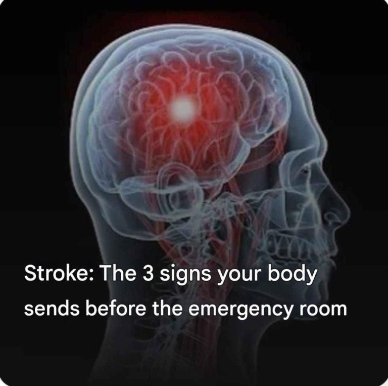 Stroke: the 3 signs your body sends before the emergency room… see more…