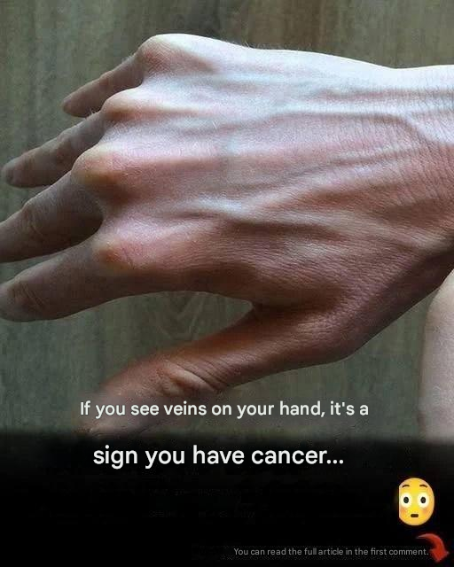Visible veins explained: common causes, health risks, and when to worry.