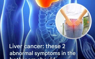 Liver cancer: the symptoms of this disease that caused the death of Thierry Ardisson