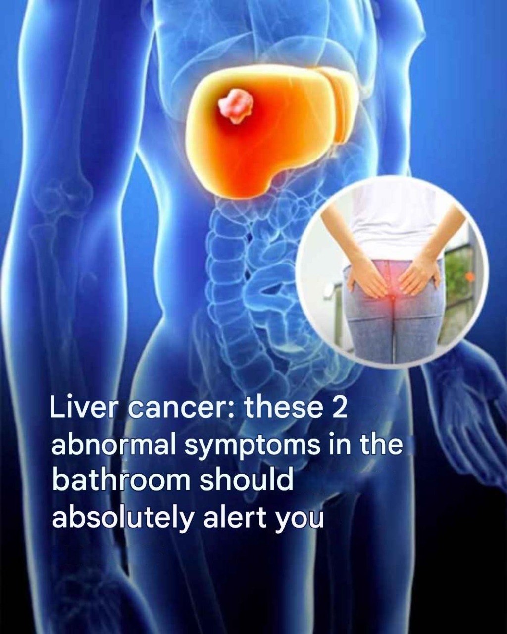Liver cancer: the symptoms of this disease that caused the death of Thierry Ardisson