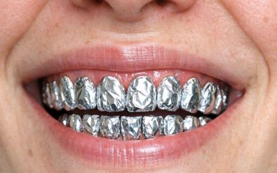 Wrap your teeth in aluminum foil & get this dazzling outcome