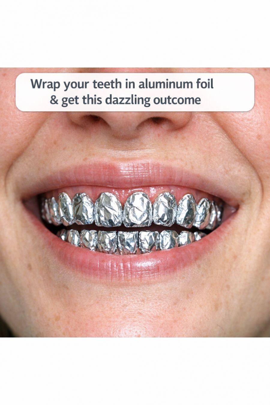Wrap your teeth in aluminum foil & get this dazzling outcome