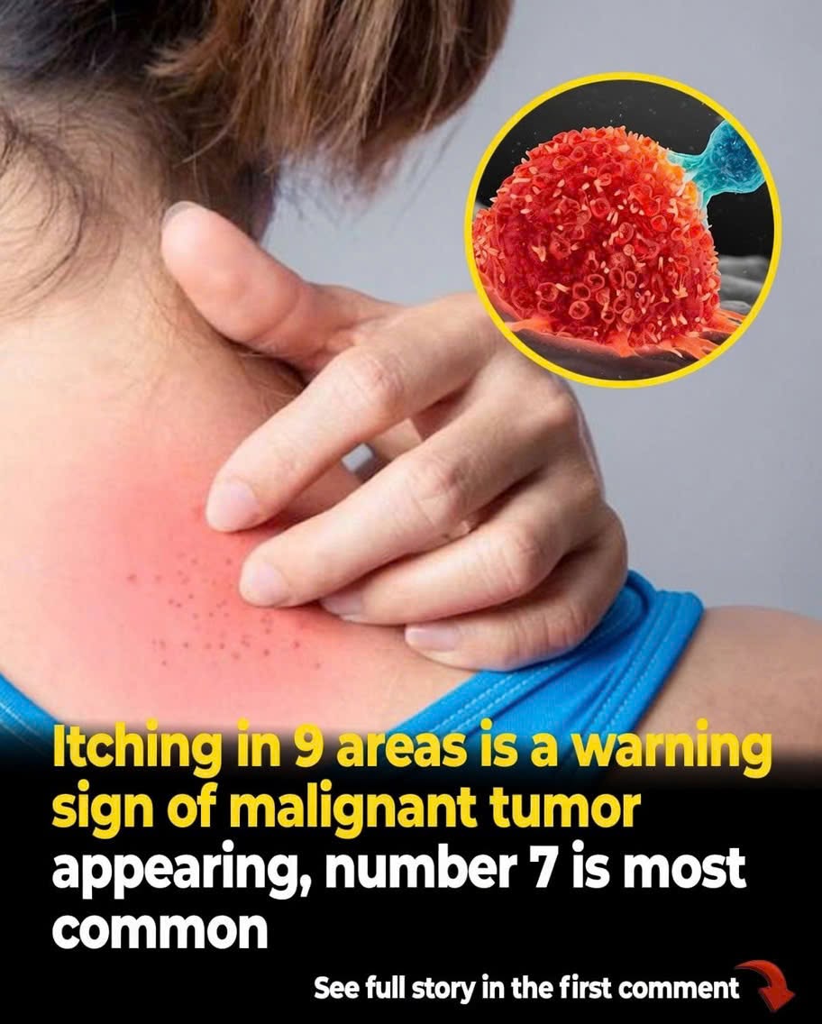 These 9 Unusual Itching Symptoms Could Be Your Body’s Way of Signaling Underlying Illness…👇👇👇
