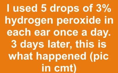 I used 5 drops of 3% hydrogen peroxide in each ear once a day. 3 days later, this is what happened