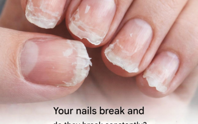 Brittle or fragile nails: what your body is trying to tell you