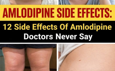 Top 12 Amlodipine Side Effects You Might Not Hear About (And How to Manage Them)