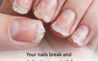 Brittle or fragile nails: what your body is trying to tell you